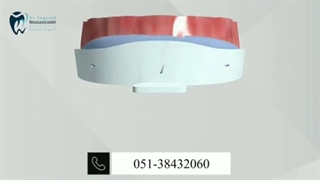 مرتب کردن دندانها