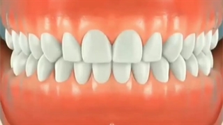 فیلم جراحی دندان عقل