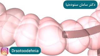 فیلم کولونوسکوپی