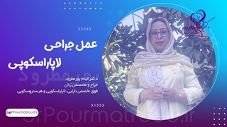 عمل جراحی لاپاراسکوپی