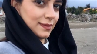 یک سال بعد از عمل جراحی زیبایی بینی