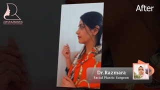جراحی زیبایی بینی