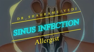 سینوس ها چه هستند؟