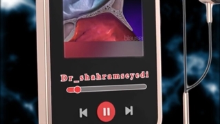 شما بنظرتون جرو افرادی هستید که واکسن آلرژی رو باید حتما بزنید؟