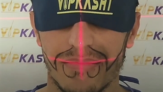 کاشت ریش با متد روز دنیا و بالا ترین کیفیت موجود- کلینیک vip