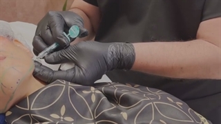 لیفت و حجم دهی صورت