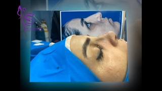 فیلم جراحی بینی