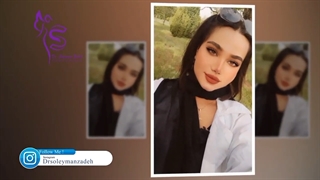 فیلم 5 ماه پس از جراحی بینی