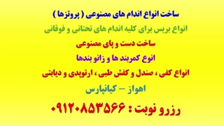 بهترین کلینیک ارتوپدی فنی در اهواز و استان خوزستان-تولید اندام های مصنوعی