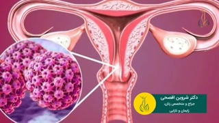 برای درمان ضایعات پوستی افراد مبتلا به hpv از چه روشی استفاده می شود؟