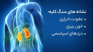صفر تا ۱۰۰ سنگ کلیه