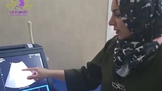 بارداری بعد از 6 سال !!