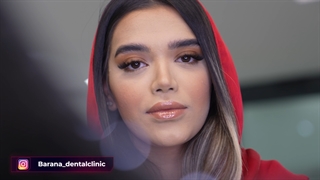 انجام 16 واحد ونیر کامپوزیت دندان