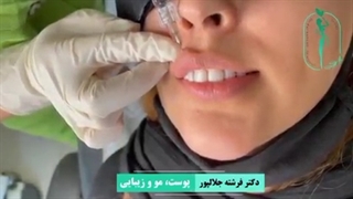 با تزریق چند سی سی فیلر ، تغییر را در زیبایی خود احساس کنید.