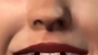 انیمیشن ارتودنسی