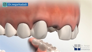 انیمیشن ارتودنسی