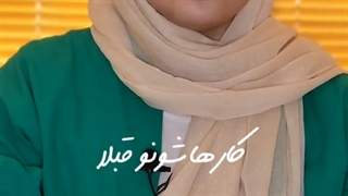 کامپوزیت ونیر در اصفهان دکتر کچوئی و دکتر کامران