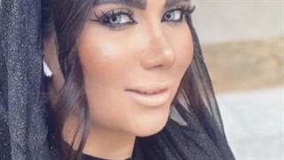 بینی نیمه فانتزی بعد از 4 سال