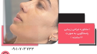 بهترین جراحی بینی