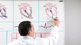EKG Basics | How to Read & Interpret EKGs: Updated Lecture