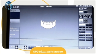 آشنایی با work station دستگاه OPG