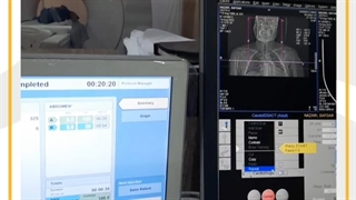 سی تی اسکن آنژیوگرافی کاروتید بخش آخر