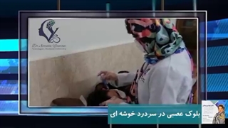 بلوک عصبی در سردرد خوشه ای