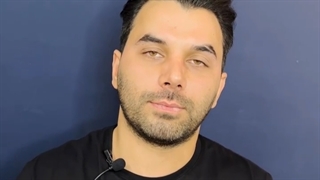 جراحی بینی بعد از 2 ماه با وجود تورم فراوان