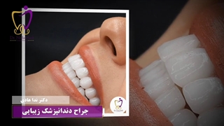 کامپوزیت دندان