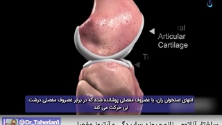 ساختار آناتومی زانو و روند ساییدگی و آرتروز مفصل | دکتر طاهریان
