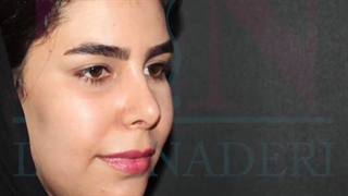 نتیجه جراحی رینوپلاستی برای مراجعه کننده عزیزمون