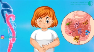 دلایل ایجاد نفخ معده