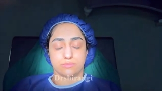 آیا جراحی بینی باعث بهبود تنفس می شود؟