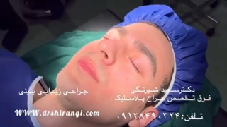 عمل بینی چقدر موفق است؟ درصد موفقیت جراحی بینی