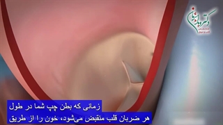 تعویض دریچه آئورت