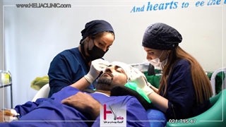 کاشت مو به صورت VIP و تجربه‌ای لوکس از بازیابی موهای زیبا