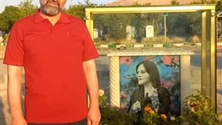 مهدی نصیری نادان لیزر صورت