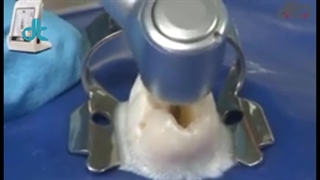 اپکس فایندر دمپکس DEMPEX