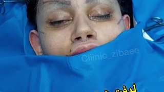 لیفت ابرو و تراش استخوان در کلینیک آرتین