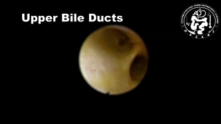 کلدوکوسکوپی