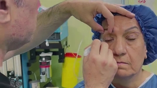 بلفاروپلاستی پلک بالا و پایین در مشهد