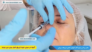 آموزش تزریق فیلر بینی | دکتر بیدکی