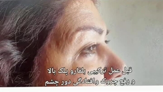 کلینیک پوست و زیبایی دکتر محسن جوهری بررسی لک صورت