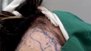 دکتر محمد علی نیلفروش زاده جراحی گوش