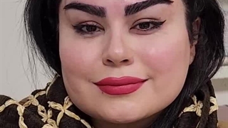 تخفیفات کاشت ابرو در کلینیک آوینا