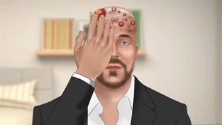 *Hamonium Asmr 2024*اصلاح صورت و درمان چرک عفونت جوش ریش،درمان جوش سر و اصلاح موی سر-قسمت پانزدهم پالپوتومی